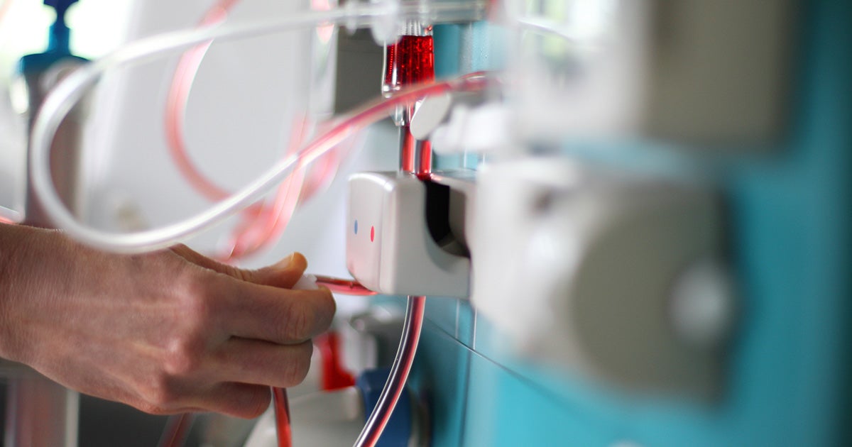 Filtering Dialysis Myths from Facts National Kidney Foundation